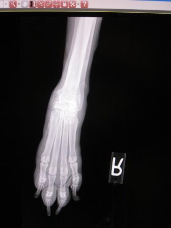 Digital X-Ray